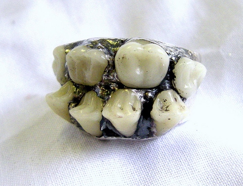 Teeth mounted on a ring.