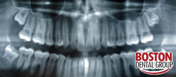 mouth oral surgery