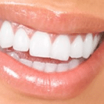 white teeth