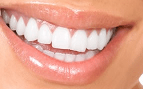 white teeth