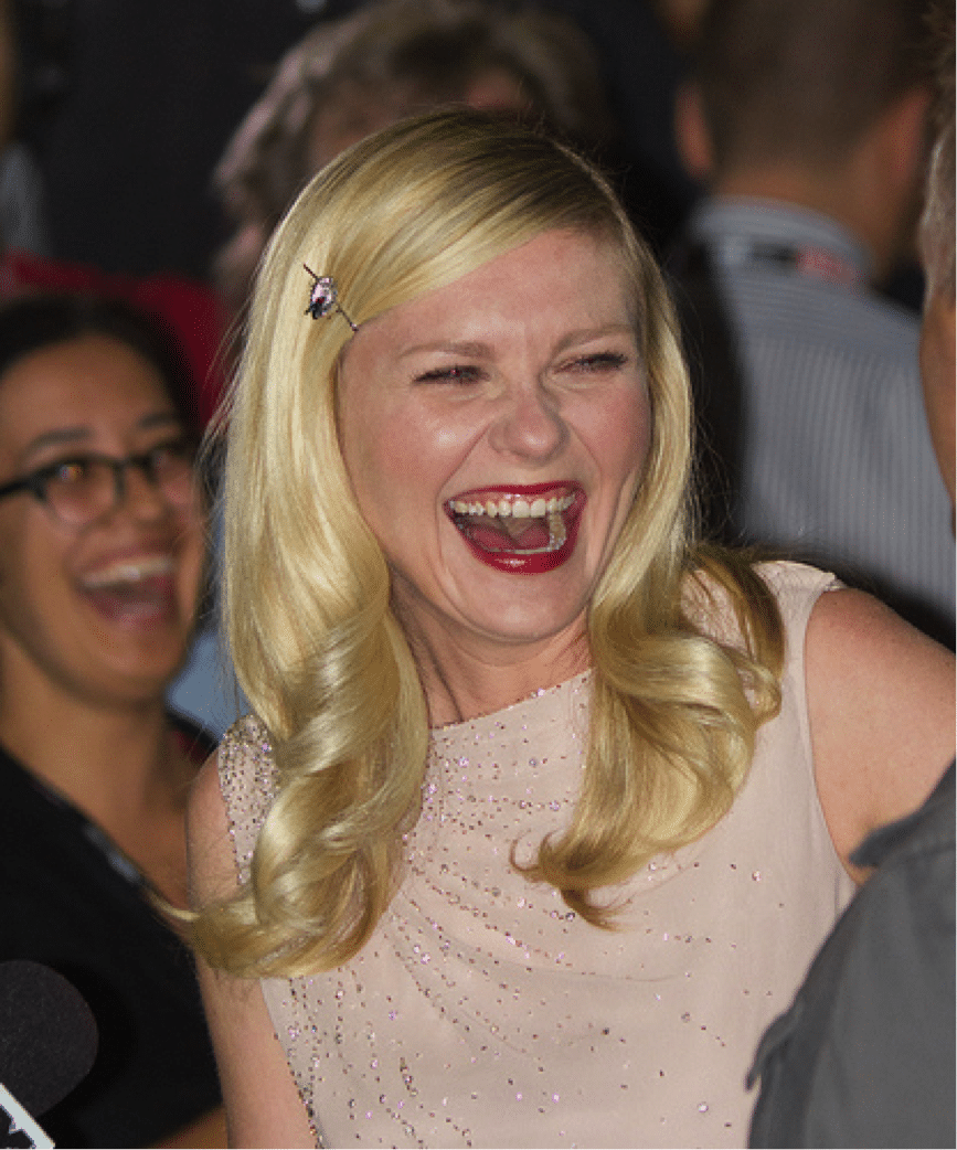 Kirsten Dunst's teeth