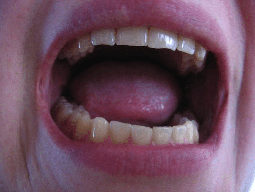 mouth