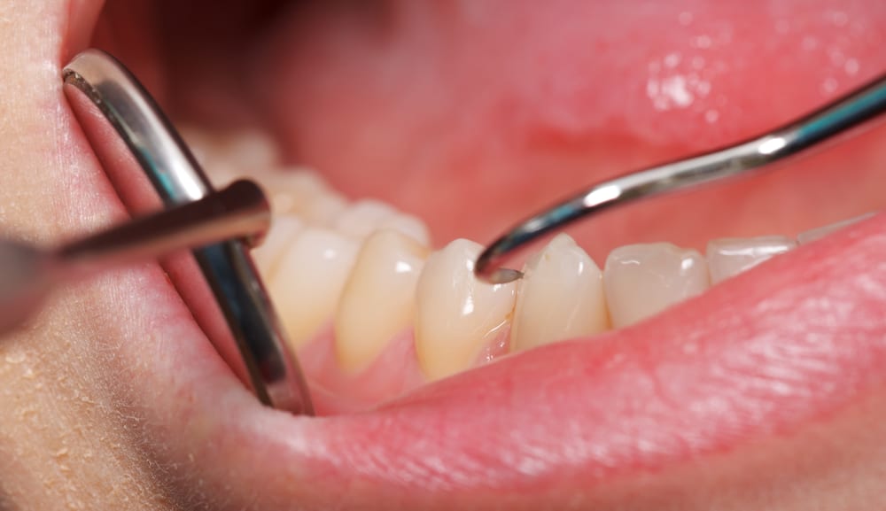 Dental patient receiving care from a dentist