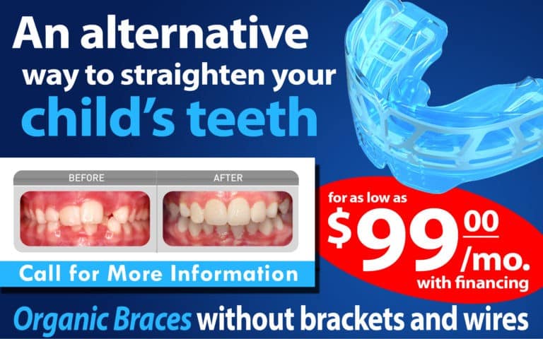 Organic Braces - BDG Las Vegas Dentists