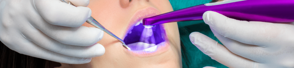 The Pros and Cons of Dental Sealants and Fluoride