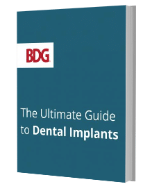 The ultimate guide to dental implants booklet
