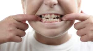 young girl showing teeth