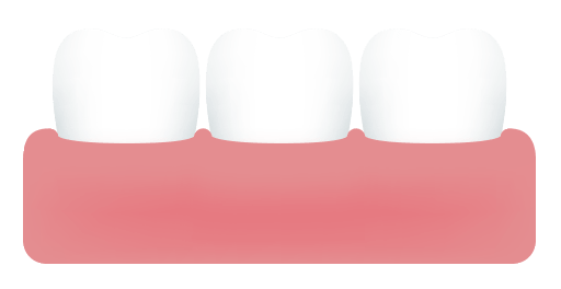 Healthy Gums