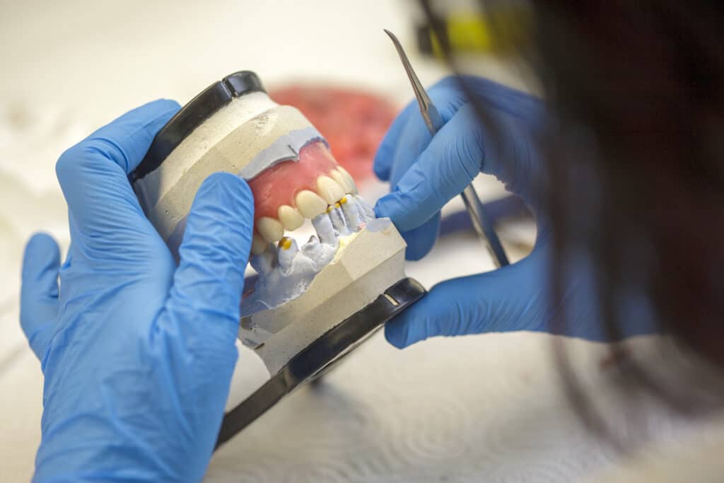 How do dentures work? Which dentures are right for you? 