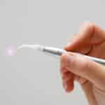 laser therapy for gums